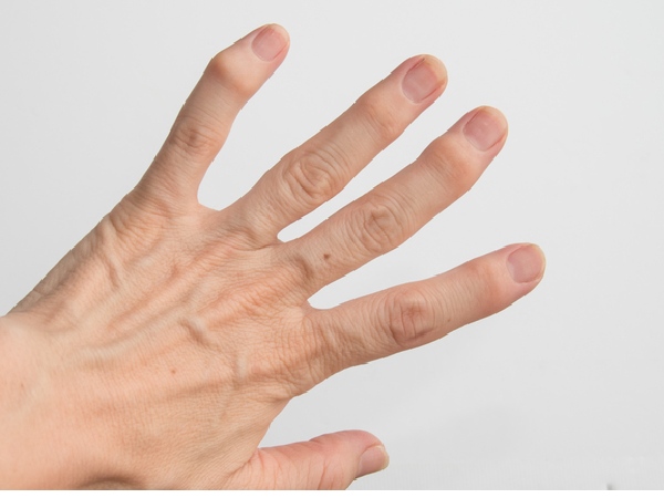 93％以上節約 ヘバーデン結節は自分で治せる 指先の激痛 腫れ しびれ
