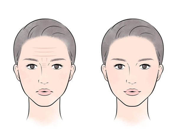 眉間・額のシワの原因は筋肉！対策とおすすめ化粧品 | ハルメク美と健康