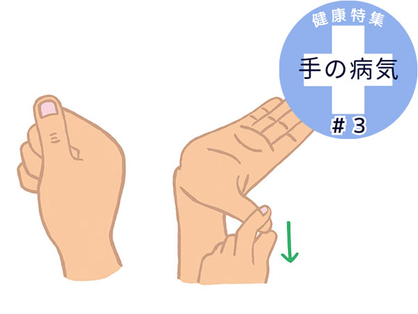 指の痛み・腫れを改善！専門医が教える「指エクサ」2