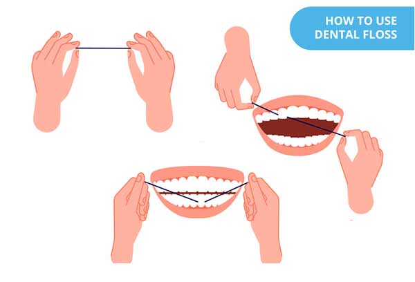 手順4：フロスを使った歯間清掃