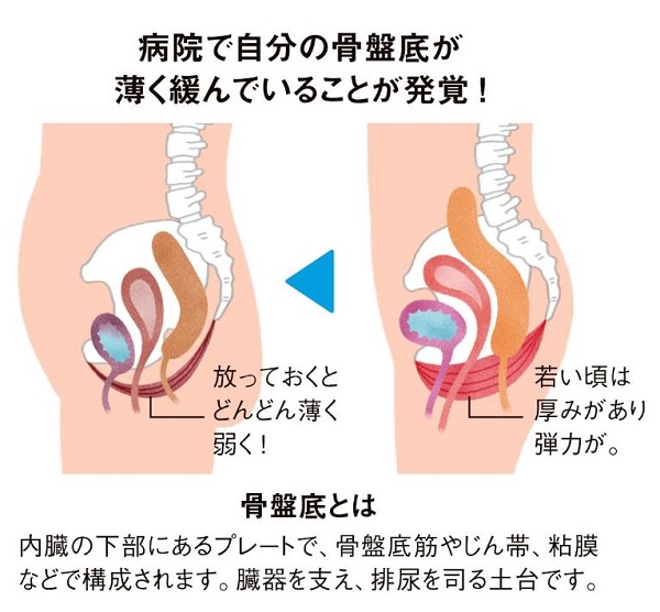 勇気を出して病院へ。原因は「骨盤底の緩み」