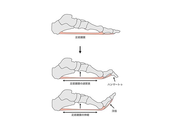 足の説明2