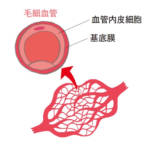 1-7_血流力の低下で生じる「ゴースト血管」