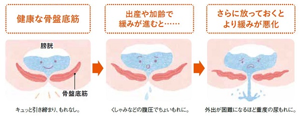 そもそも、トイレのお悩みはどうして起こる？