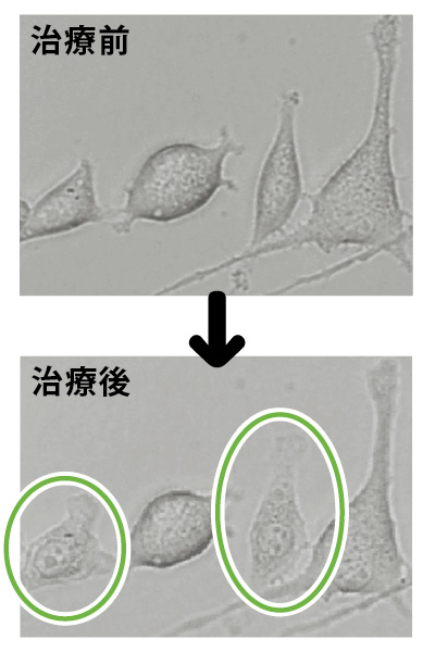 がん細胞だけを狙って攻撃する光免疫療法