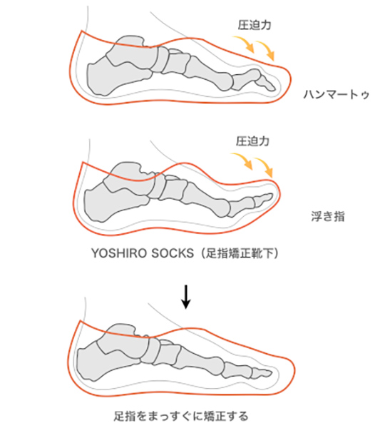 足の裏に痛みがある場合に考えられる原因と対処法 ハルメク美と健康