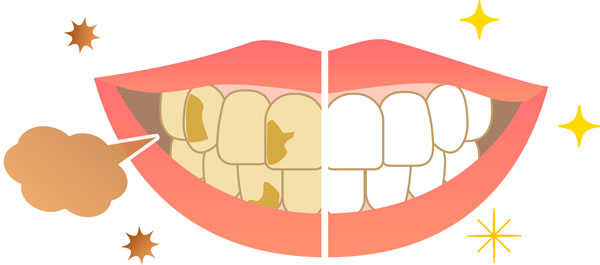 「なぜ歯が黄ばむ？」歯の黄ばみも老化の一つ