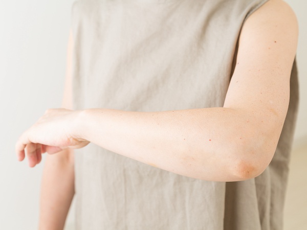 腕のだるさや肘から下の痛み、しびれの原因は？