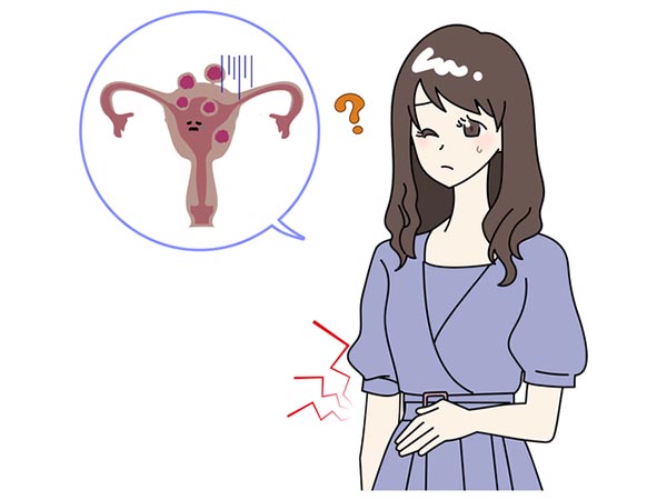 なぜ子宮筋腫ができるのか、原因は不明です　